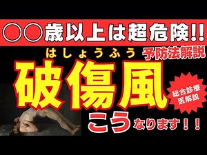 【〇〇歳以上は超危険‼️】破傷風とは？原因・症状・治療・予防法・ワクチンについて総合診療医が詳細に解説