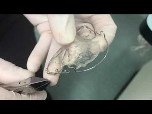 Issuing a hawley orthodontic retainer