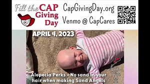 Children's Alopecia Project on Reels