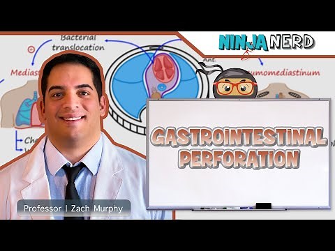 Gastrointestinal Perforation | Clinical Medicine