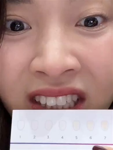 Trắng dã man luôn ấy, Smilee Extra trắng răng bật 2-6 tone sau 1 liệu trình 5-7 ngày sử dụng nha các mom #smileeextra #kittrangrangsmilee #kittrangrang #smileeextrahn #trangrangsmileeextra #Smilee