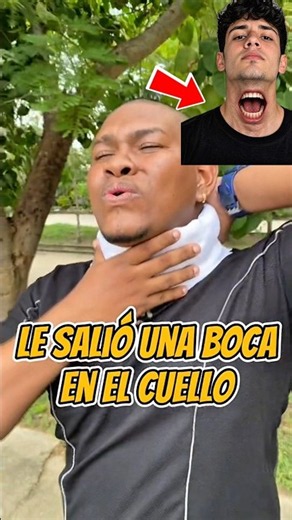 Le salió una boca en el cuello 😱😨😱😨 #viral #youtubeshorts #shorts #fyp #viralvideo