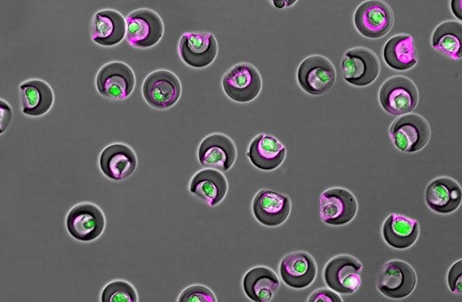 Sorting therapeutic stem cells by function improves healing after heart attack, lab study shows