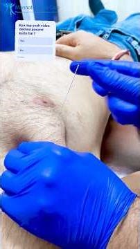 Treating muscle imbalance case #doctor #physiotherapist #painrelief