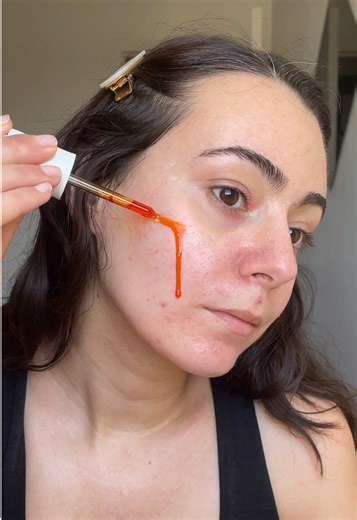 When you have acne, it means having regular crying sessions 🥲 But in the end, we still manage to be cute anyway right? 🥹 ✨Clarifying Bacne Spray @Clear Start ✨Tone Pads Kojic Acid @medicube global ✨Byoma Redness Relief Soothing Toner @byoma ✨Healthy Glow Concentrate serum @La Rosée Cosmétiques ✨Breakout Biotic Moisturizer @dermalogica / @Dermalogica France ✨Brow Gel @Rare Beauty ✨ReFresh Eye Brightener SPF30 Correcteur (shade “Cherish“) @RMS Beauty ✨Easy Bake Powder (shade “Cherry Blossom Cake