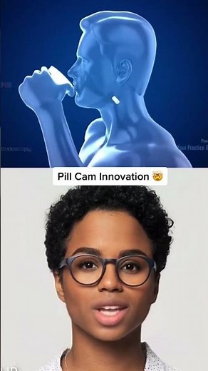 Pillcam innovation for medical science 🤯