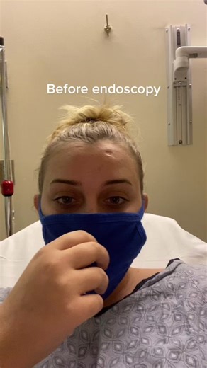 Endoscopy Procedure Before and After TikTok