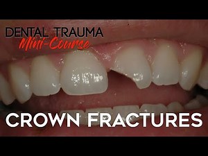 Dental Trauma Mini-Course - Part 4 - Dental Trauma Guide - Crown Fractures • Video • MEDtube.net