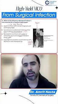 Ileocecal Tuberculosis vs Crohn’s Disease | Radiological Signs Explained by Dr. Amrit Nasta