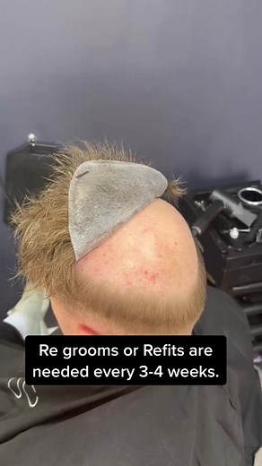 126K views · 555 reactions | Hair Replacement System - Regrooms/Refits EXPLAINED #hairreplacement #hairreplacementsystem #hairsystem #hairsystems #naturalhairline #fakehairdontcare #hairsystemformen #hairsystemforwomen #hairtransformation #hairtransformations #novocabelo | novocabelohair | Facebook