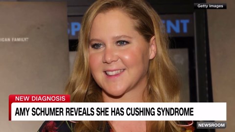What is Cushing syndrome and how does it affect Amy Schumer?