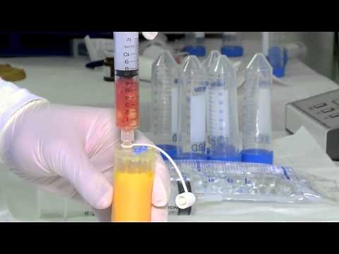 U.S. Stem Cell Clinic: How is Stem Cell Therapy Performed?