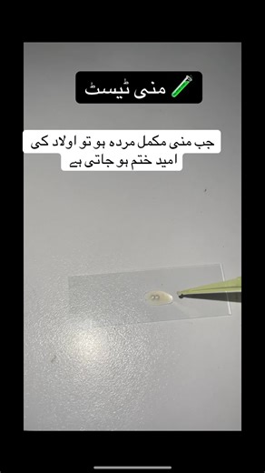 Understanding Semen Analysis for Male Fertility