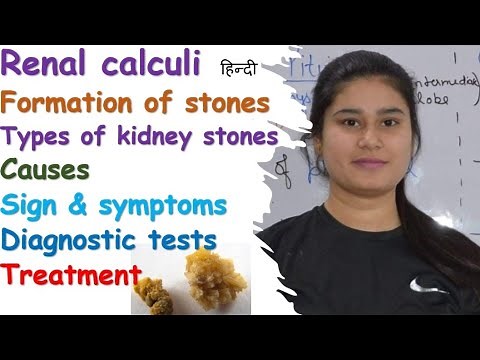 Renal Calculi | Formation of Stones | Types | Causes | Symptoms | Diagnose | Treatment