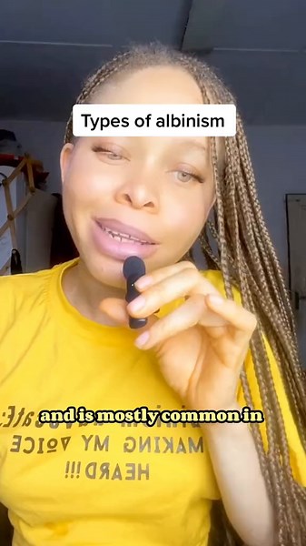 Understanding the 7 Types of Albinism and Their Features