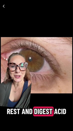 What is Miosis? Understanding Eye Reflexes