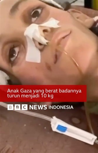 5.6K views · 137 reactions | Mosab, anak 14 tahun di Gaza, terluka...