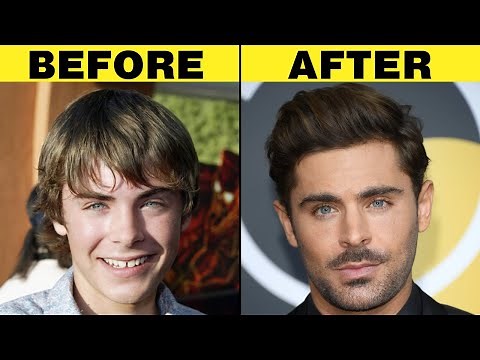 15 Most AMAZING Celebrity Glow Ups
