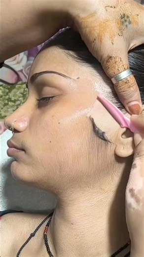 Remove Facial Hair Naturally At Home ✅ #glowup #hair #shorts #shortvideo