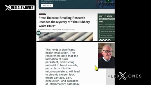 Dr. John Campbell Decodes The Mystery Of "The White Rubbery Clots" Discovered To Be A Biochemical Matrix Cast Inside of Blood Vessels Found In Victims Of COVID Vaccine Catastrophic Adverse Reactions.See The Full Bombshell Report Here: https://t.co/4wWElnf5ks