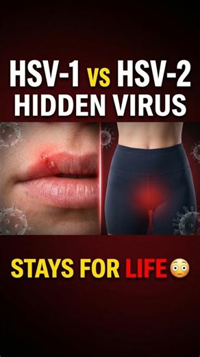 Herpes Never Leaves Your Body | Explained Simply #hpv #facts #cervicalcancer #healthawareness