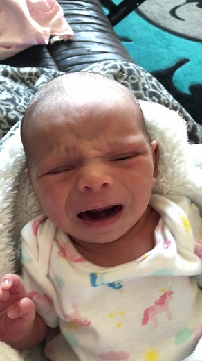 Understanding Cri Du Chat Syndrome in Infants