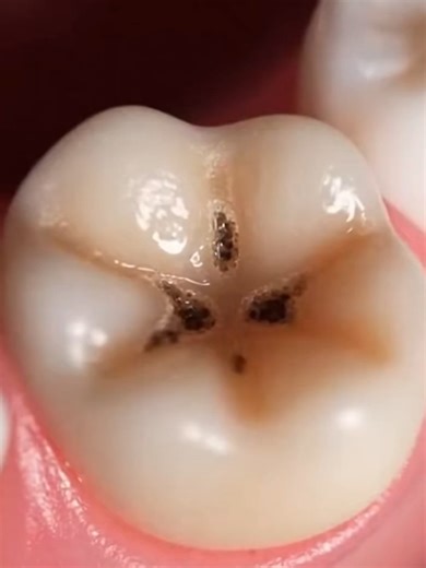 Explore Chewable Toothpaste Alternatives for Oral Care