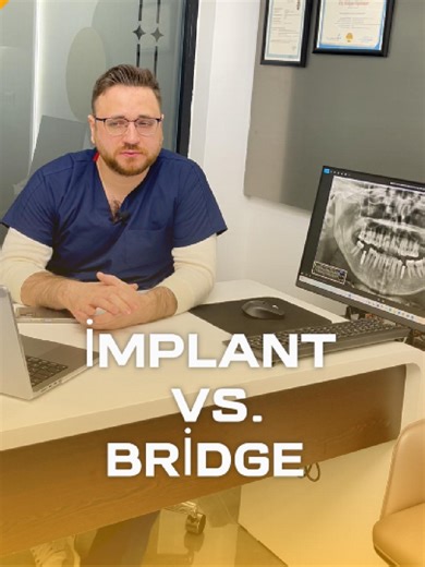 Bridge vs. Implant: Which Dental Solution is Best?