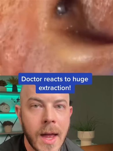 Doctor reacts to MASSIVE extraction! #pimplepop #doctorreacts #dermreacts #dermatologist #ear