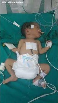 NICU baby #viral #baby #subscribe @viralhog @ShivaputraChavar#youtubeshorts