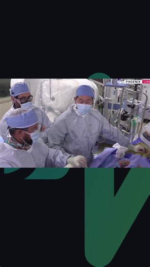 Rhythm Interventions Online on Instagram: "Dr Roderick Tung demonstrates epicardial access techniques during a live epicardial VT ablation case, focusing on safety and real-world decision-making. A short Agilis sheath is introduced over the wire, with dual pericardial access established as a precaution for rapid evacuation in the event of tamponade. Multiple access points are discussed to enable effective anterior, posterior, and lateral drainage and reduce the risk of pericardial thrombus. As t