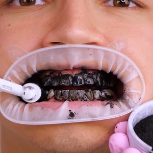 Safety solutions & hacks for common problems! 🤯 | Simple ideas