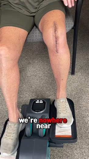 If you’ve recently had a total knee replacement and you’re thinking about buying a piece of exercise equipment for home… stop scrolling. 🦵 . The Cubii might just be the best investment you can make for your recovery. 💪 . Here’s why: Most exercise equipment — even simple pedal machines — can feel unstable, awkward, or too demanding right after surgery. But the Cubii is different. . It’s small, solid, and stable enough to use from almost any chair. You don’t need to stand. You don’t even need to