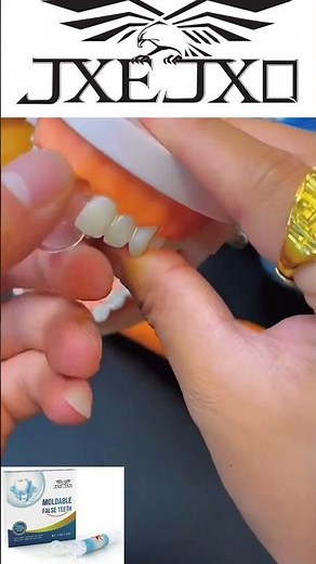 Fix your smile in minutes! Moldable false tooth kit for quick, easy repairs #teeth #repair #tooth #🦷
