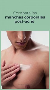 351 reactions · 26 shares | Reduce manchas post-acné en espalda, pecho y hombros con Eucerin DermoPure Crema Corporal. | Eucerin | Facebook