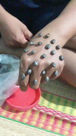 Effective Ticks Removal Techniques for Better Health