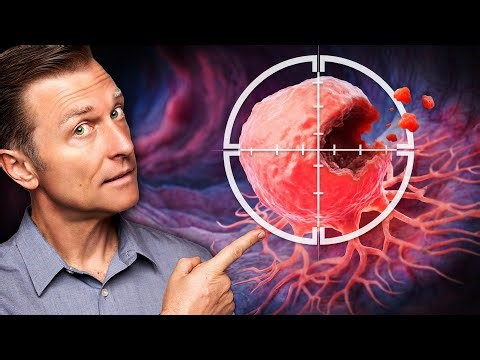 Advanced-Stage Colon Cancer Dies When You Do THIS