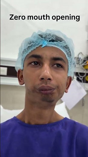 Awake Fibreoptic Intubation Done for zero mouth opening patient .
