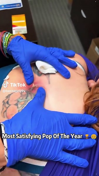 Why is this so disgusting yet so addictive? 🤮❤️🔄 #fyp #viral #trending #guiltypleasure #addictive #gross #pimple #weird