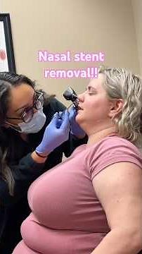 👃 Nasal Stent Removal! (Septoplasty)