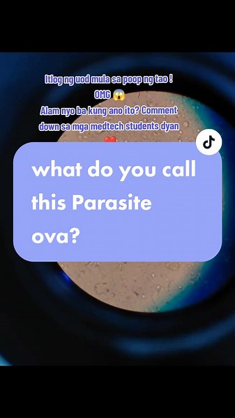 Parasite ova found in stool sample . Most common parasitic ito lalo na sa mga bata dahil mahilig sila maglaro sa lupa and lalo na pag di naghuhugas ng kamay bago kumain . It is a roundworm. #medtechstudent #medtech #laboratory #lab #fecalysis #greizelleysanelizaga