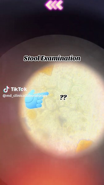 Understanding Stool Examination Results in Clinical Labs