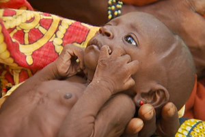 Hunger stalks Niger children