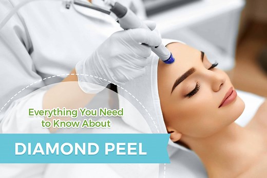 Everything You Need to Know about Diamond Peel — Skin MD - Dermatologist in Ortigas, Pasig