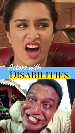 Actors suffering from disability in real life #bollywood