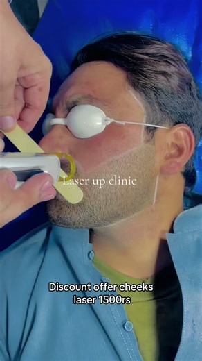 Laser Treatment for Facial Rejuvenation Explained