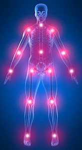 Prolozone Therapy · Dr. David Palacios, ND