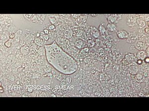 Entamoeba hystolytica 赤痢アメーバ 寄生虫