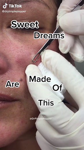 Reacting to Dr. Pimple Popper: Who Are You to Disagree?