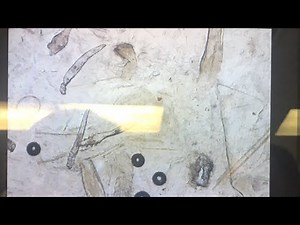 Demodex Mites Under the Microscope | Seborrheic Dermatitis | Ungex Australia